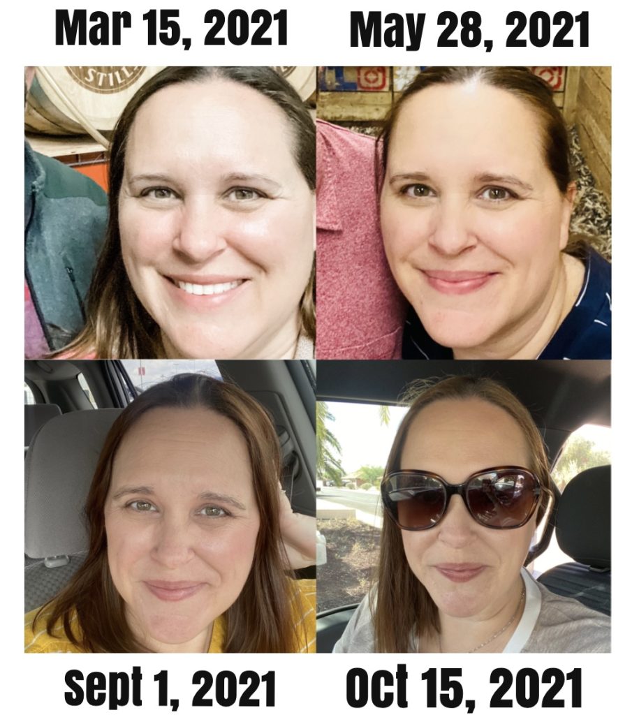 side by side photos with several months of weight loss